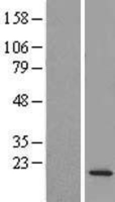 Western Blot: C14orf126 Overexpression Lysate (Adult Normal) [NBL1-08172] Left-Empty vector transfected control cell lysate (HEK293 cell lysate); Right -Over-expression Lysate for C14orf126.
