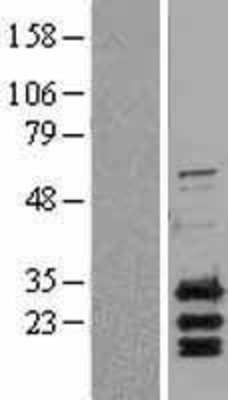 Western Blot: PUMA Overexpression Lysate (Adult Normal) [NBL1-07925] Left-Empty vector transfected control cell lysate (HEK293 cell lysate); Right -Over-expression Lysate for PUMA.