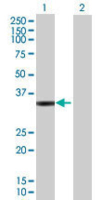 Lane 1: RDH12 transfected lysate (34.87 KDa) Lane 2: Non-transfected lysate.