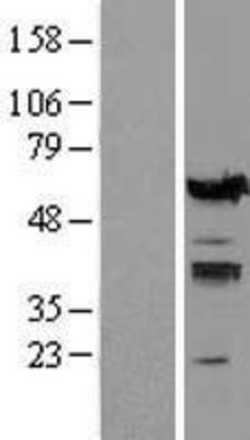 Western Blot: IRF5 Overexpression Lysate (Adult Normal) [NBL1-12035] Left-Empty vector transfected control cell lysate (HEK293 cell lysate); Right -Over-expression Lysate for IRF5.