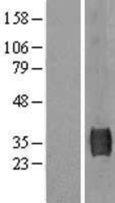 Western Blot: SUSD3 Overexpression Lysate (Adult Normal) [NBL1-16623] Left-Empty vector transfected control cell lysate (HEK293 cell lysate); Right -Over-expression Lysate for SUSD3.