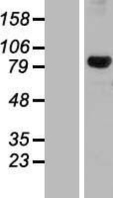 Western Blot: DHX32 Overexpression Lysate (Adult Normal) [NBL1-09881] Left-Empty vector transfected control cell lysate (HEK293 cell lysate); Right -Over-expression Lysate for DHX32.