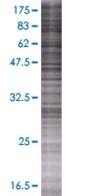 RDH12 transfected lysate.