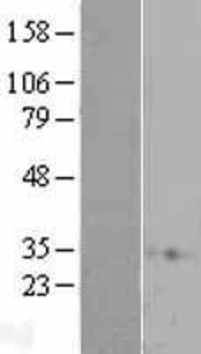 Western Blot: RAP1A Overexpression Lysate (Adult Normal) [NBL1-15145] Left-Empty vector transfected control cell lysate (HEK293 cell lysate); Right -Over-expression Lysate for RAP1A.