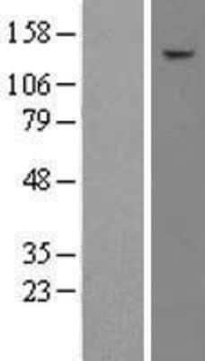 Western Blot: TAF2 Overexpression Lysate (Adult Normal) [NBL1-16686] Left-Empty vector transfected control cell lysate (HEK293 cell lysate); Right -Over-expression Lysate for TAF2.