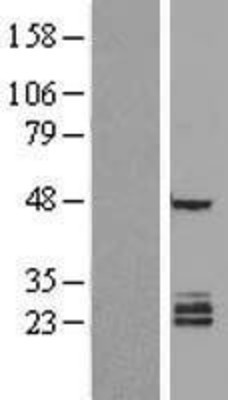 Western Blot: FAM3B Overexpression Lysate (Adult Normal) [NBL1-10522] Left-Empty vector transfected control cell lysate (HEK293 cell lysate); Right -Over-expression Lysate for FAM3B.