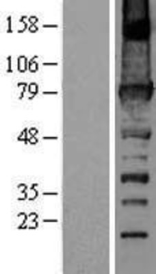 Western Blot: URP2 Overexpression Lysate (Adult Normal) [NBL1-10678] Left-Empty vector transfected control cell lysate (HEK293 cell lysate); Right -Over-expression Lysate for URP2.