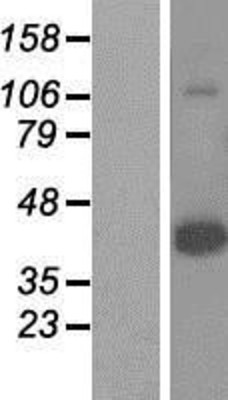 Western Blot: HORMAD1 Overexpression Lysate (Adult Normal) [NBP2-06072] Left-Empty vector transfected control cell lysate (HEK293 cell lysate); Right -Over-expression Lysate for HORMAD1.