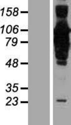 Western Blot: CCDC21 Overexpression Lysate (Adult Normal) [NBP2-06406] Left-Empty vector transfected control cell lysate (HEK293 cell lysate); Right -Over-expression Lysate for CCDC21.