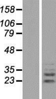 Western Blot: PLEKHF2 Overexpression Lysate (Adult Normal) [NBP2-06314] Left-Empty vector transfected control cell lysate (HEK293 cell lysate); Right -Over-expression Lysate for PLEKHF2.