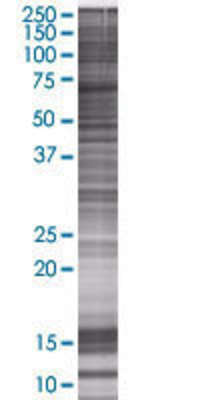 BTD transfected lysate.