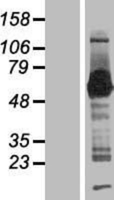 Western Blot: SMAP1 Overexpression Lysate (Adult Normal) [NBP2-06502] Left-Empty vector transfected control cell lysate (HEK293 cell lysate); Right -Over-expression Lysate for SMAP1.