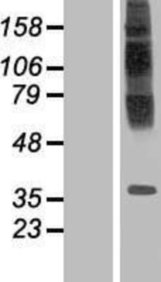 Western Blot: TM6SF1 Overexpression Lysate (Adult Normal) [NBP2-06368] Left-Empty vector transfected control cell lysate (HEK293 cell lysate); Right -Over-expression Lysate for TM6SF1.