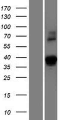 Western Blot: DSN1 Overexpression Lysate (Adult Normal) [NBP2-06273] Left-Empty vector transfected control cell lysate (HEK293 cell lysate); Right -Over-expression Lysate for DSN1.