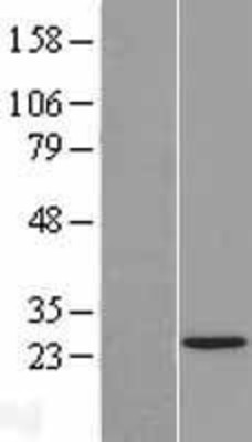 Western Blot: TAF11 Overexpression Lysate (Adult Normal) [NBL1-16680] Left-Empty vector transfected control cell lysate (HEK293 cell lysate); Right -Over-expression Lysate for TAF11.