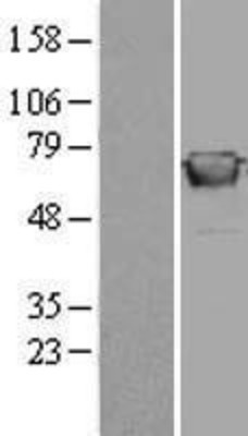 Western Blot: GBP2 Overexpression Lysate (Adult Normal) [NBL1-10997] Left-Empty vector transfected control cell lysate (HEK293 cell lysate); Right -Over-expression Lysate for GBP2.