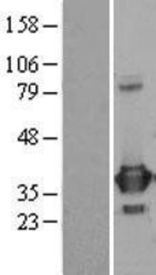 Western Blot: PRPS1 Overexpression Lysate (Adult Normal) [NBL1-14827] Left-Empty vector transfected control cell lysate (HEK293 cell lysate); Right -Over-expression Lysate for PRPS1.