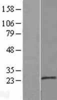 Western Blot: MOSPD1 Overexpression Lysate (Adult Normal) [NBL1-13191] Left-Empty vector transfected control cell lysate (HEK293 cell lysate); Right -Over-expression Lysate for MOSPD1.