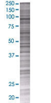 HK1 transfected lysate.