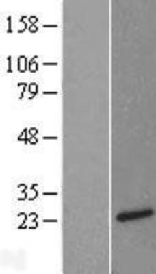 Western Blot: Neurotensin Overexpression Lysate (Adult Normal) [NBL1-13841] Left-Empty vector transfected control cell lysate (HEK293 cell lysate); Right -Over-expression Lysate for Neurotensin.