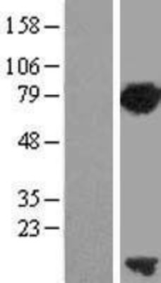 Western Blot: PCNA associated factor Overexpression Lysate (Adult Normal) [NBL1-12236] Left-Empty vector transfected control cell lysate (HEK293 cell lysate); Right -Over-expression Lysate for PCNA associated factor.