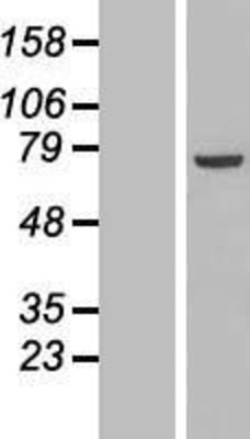 Western Blot: PPP1R16B Overexpression Lysate (Adult Normal) [NBL1-14677] Left-Empty vector transfected control cell lysate (HEK293 cell lysate); Right -Over-expression Lysate for PPP1R16B.
