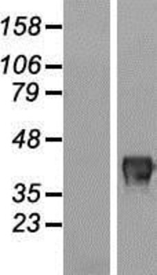 Western Blot: FAM83A Overexpression Lysate (Adult Normal) [NBL1-10573] Left-Empty vector transfected control cell lysate (HEK293 cell lysate); Right -Over-expression Lysate for FAM83A.