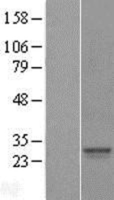 Western Blot: SRY Overexpression Lysate (Adult Normal) [NBL1-16462] Left-Empty vector transfected control cell lysate (HEK293 cell lysate); Right -Over-expression Lysate for SRY.