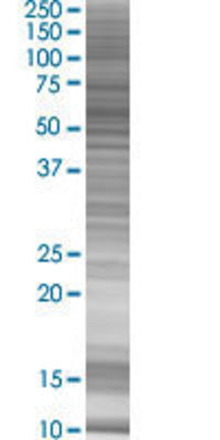 MCRS1 transfected lysate.