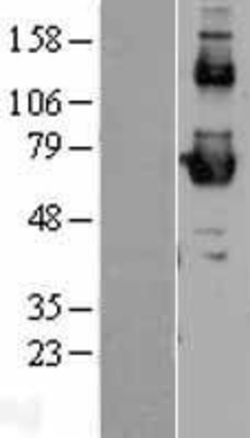 Western Blot: SR-BI Overexpression Lysate (Adult Normal) [NBL1-15720] Left-Empty vector transfected control cell lysate (HEK293 cell lysate); Right -Over-expression Lysate for SR-BI.