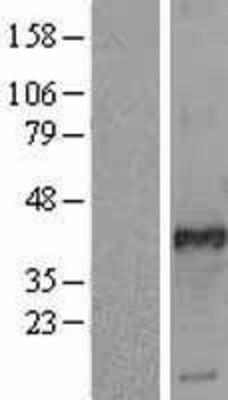 Western Blot: FRA2 Overexpression Lysate (Adult Normal) [NBL1-10797] Left-Empty vector transfected control cell lysate (HEK293 cell lysate); Right -Over-expression Lysate for FRA2.