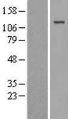Western Blot: JAK3 Overexpression Lysate (Adult Normal) [NBL1-12094] Left-Empty vector transfected control cell lysate (HEK293 cell lysate); Right -Over-expression Lysate for JAK3.