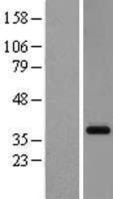 Western Blot: GPR26 Overexpression Lysate (Adult Normal) [NBL1-11272] Left-Empty vector transfected control cell lysate (HEK293 cell lysate); Right -Over-expression Lysate for GPR26.