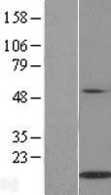 Western Blot: IL21 Overexpression Lysate (Adult Normal) [NBP2-06520] Left-Empty vector transfected control cell lysate (HEK293 cell lysate); Right -Over-expression Lysate for IL21.