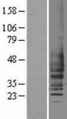 Western Blot: C5AR1 Overexpression Lysate (Adult Normal) [NBL1-08482] Left-Empty vector transfected control cell lysate (HEK293 cell lysate); Right -Over-expression Lysate for C5AR1.