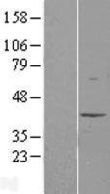 Western Blot: MAT2B Overexpression Lysate (Adult Normal) [NBL1-12911] Left-Empty vector transfected control cell lysate (HEK293 cell lysate); Right -Over-expression Lysate for MAT2B.