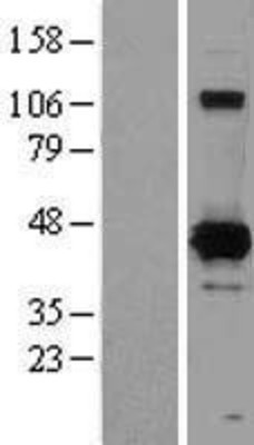 Western Blot: XRCC4 Overexpression Lysate (Adult Normal) [NBL1-17916] Left-Empty vector transfected control cell lysate (HEK293 cell lysate); Right -Over-expression Lysate for XRCC4.