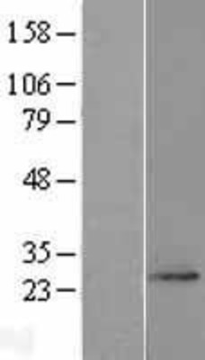 Western Blot: FAM168A Overexpression Lysate (Adult Normal) [NBL1-10495] Left-Empty vector transfected control cell lysate (HEK293 cell lysate); Right -Over-expression Lysate for FAM168A.