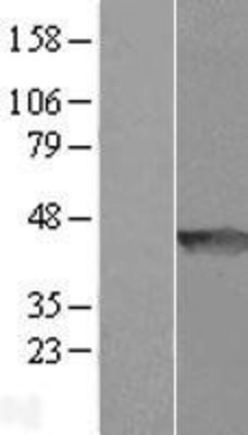 Western Blot: WDR92 Overexpression Lysate (Adult Normal) [NBL1-17836] Left-Empty vector transfected control cell lysate (HEK293 cell lysate); Right -Over-expression Lysate for WDR92.