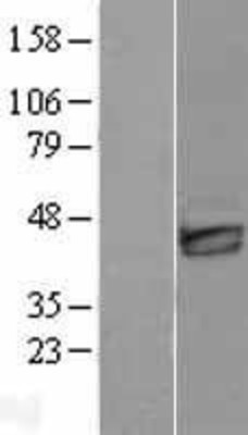 Western Blot: DKK3 Overexpression Lysate (Adult Normal) [NBL1-09904] Left-Empty vector transfected control cell lysate (HEK293 cell lysate); Right -Over-expression Lysate for DKK3.