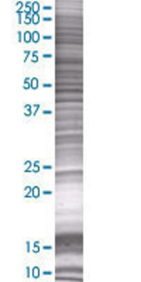 STARD5 transfected lysate.