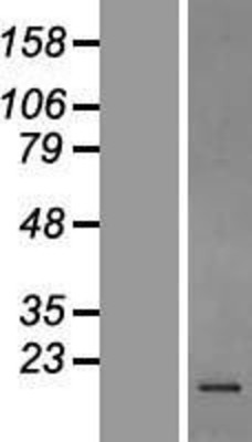 Western Blot: Stathmin 1 Overexpression Lysate (Adult Normal) [NBP2-10460] Left-Empty vector transfected control cell lysate (HEK293 cell lysate); Right -Over-expression Lysate for Stathmin 1.