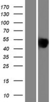 Western Blot: Sialoprotein II Overexpression Lysate (Adult Normal) [NBP2-10516] Left-Empty vector transfected control cell lysate (HEK293 cell lysate); Right -Over-expression Lysate for Sialoprotein II.