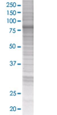 PRKCD transfected lysate.