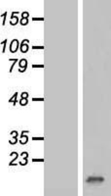 Western Blot: p15 INK4b Overexpression Lysate (Adult Normal) [NBP2-10514] Left-Empty vector transfected control cell lysate (HEK293 cell lysate); Right -Over-expression Lysate for p15 INK4b.