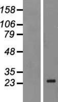 Western Blot: MAD4 Overexpression Lysate (Adult Normal) [NBP2-10411] Left-Empty vector transfected control cell lysate (HEK293 cell lysate); Right -Over-expression Lysate for MAD4.
