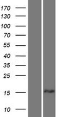 Western Blot: TPD52L1/D53 Overexpression Lysate (Adult Normal) [NBP2-10737] Left-Empty vector transfected control cell lysate (HEK293 cell lysate); Right -Over-expression Lysate for TPD52L1/D53.