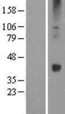 Western Blot: Wnt16 Overexpression Lysate (Adult Normal) [NBL1-17865] Left-Empty vector transfected control cell lysate (HEK293 cell lysate); Right -Over-expression Lysate for Wnt16.