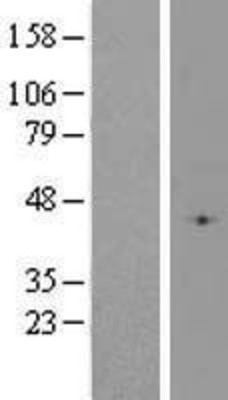 Western Blot: Glutathione Peroxidase 4 Overexpression Lysate (Adult Normal) [NBP2-10796] Left-Empty vector transfected control cell lysate (HEK293 cell lysate); Right -Over-expression Lysate for Glutathione Peroxidase 4.