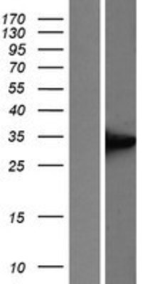 Western Blot: UCP1 Overexpression Lysate (Adult Normal) [NBP2-06511] Left-Empty vector transfected control cell lysate (HEK293 cell lysate); Right -Over-expression Lysate for UCP1.